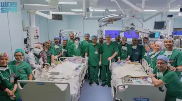 الفريق الطبي والجراحي يختتم عملية فصل التوأم الملتصق الفلبيني «كليا وموريس آن» – أخبار السعودية